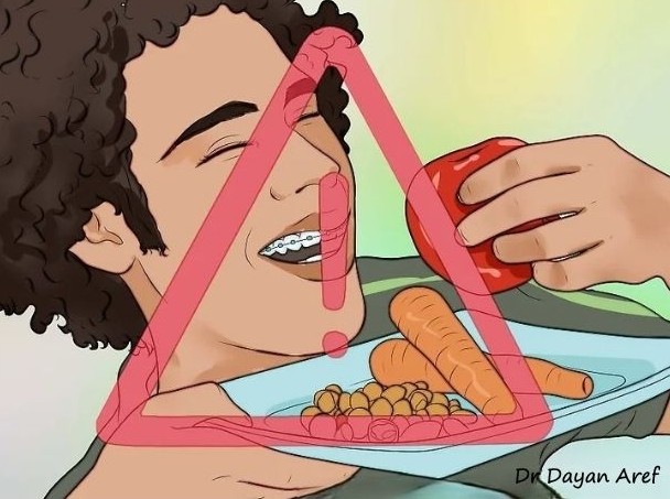 مواد غذایی نرم مناسب برای کاهش درد بعد از ارتودنسی