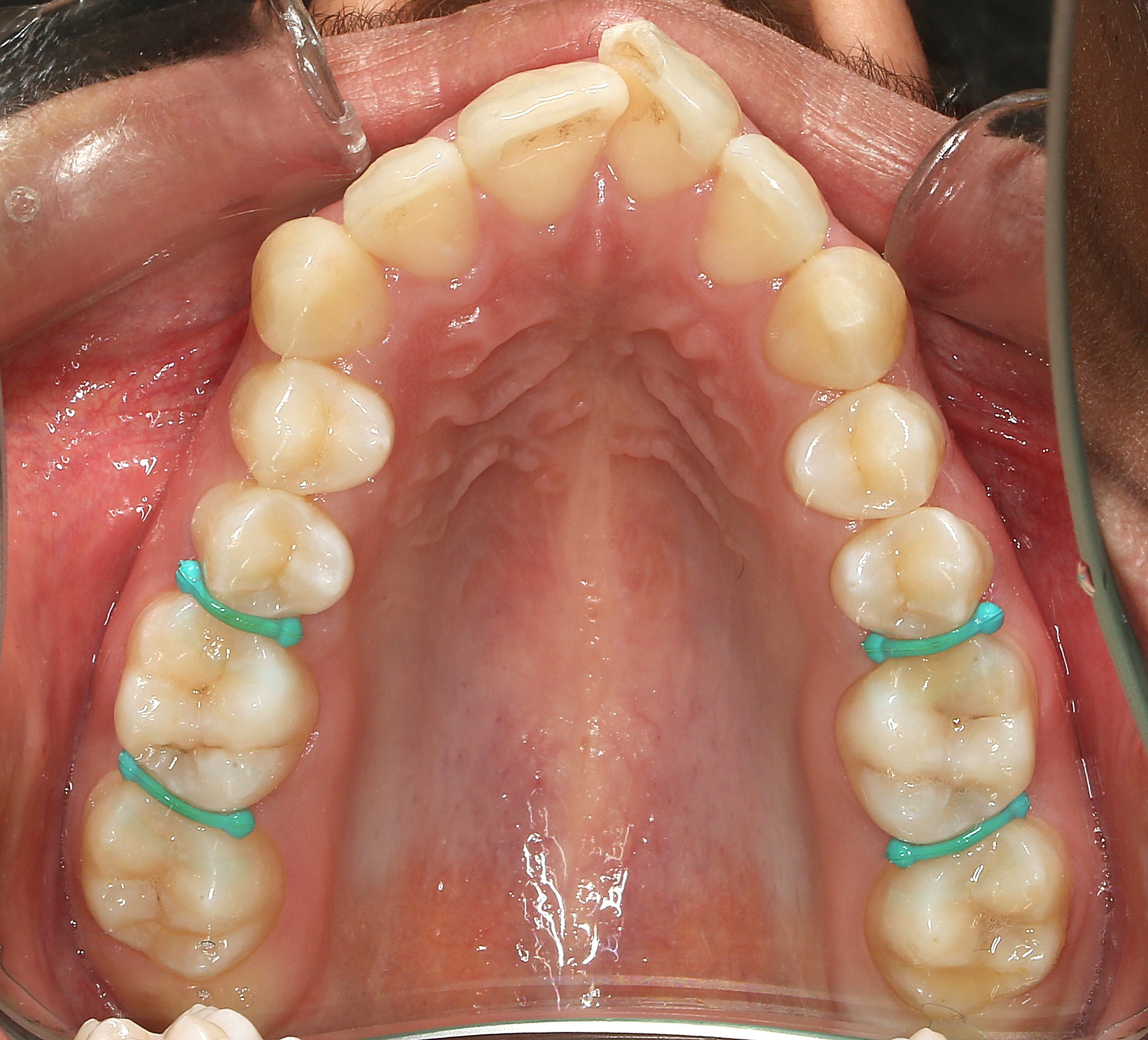 اصلاح فرم فک