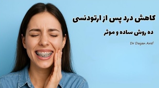درد بعد از ارتودنسی: ۱۰ روش مؤثر برای تسکین سریع درد ارتودنسی